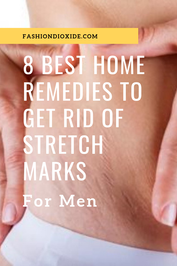 Best-Home-Remedies-To-Get-Rid-Of-Stretch-Marks-For-Men